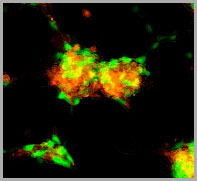 HEK293 cells transfected with enhanced green fluorescent protein (EGFP) and red fluorescent protein (RFP).